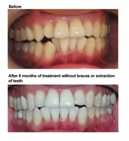 orthodontic case study